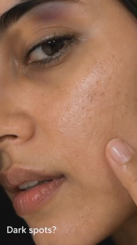 Alpha Arbutin Serum